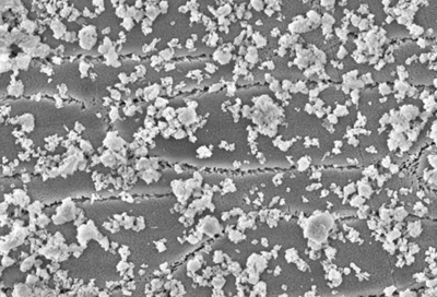 Figure 1: Hydroxyapatite particles from oral care products accumulate on the tooth surface and form a protective layer. Figure 1: Hydroxyapatite particles from oral care products accumulate on the tooth surface and form a protective layer.