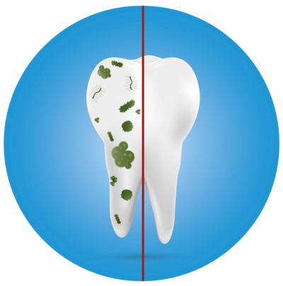 [Translate to pt_BR:] Hydroxyapatite is not impervious